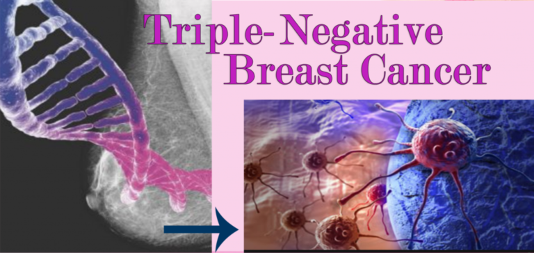 Triple-Negative Breast Cancer,TNBC - Hematology & Oncology | Cancer ...